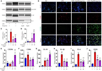 Songorine modulates macrophage polarization and metabolic reprogramming to alleviate inflammation in osteoarthritis